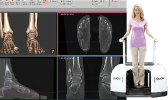 ct scan