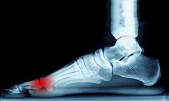 x ray