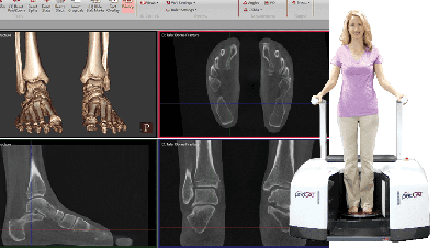 ct scan