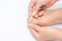 What Causes Ingrown Toenails?