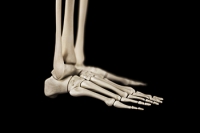 Causes and Symptoms of Foot Stress Fractures