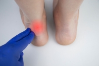 Common Symptoms of an Achilles Tendon Injury