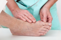 Types of Bunion Surgery