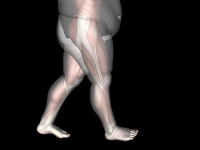 Obesity May Affect Foot Structure